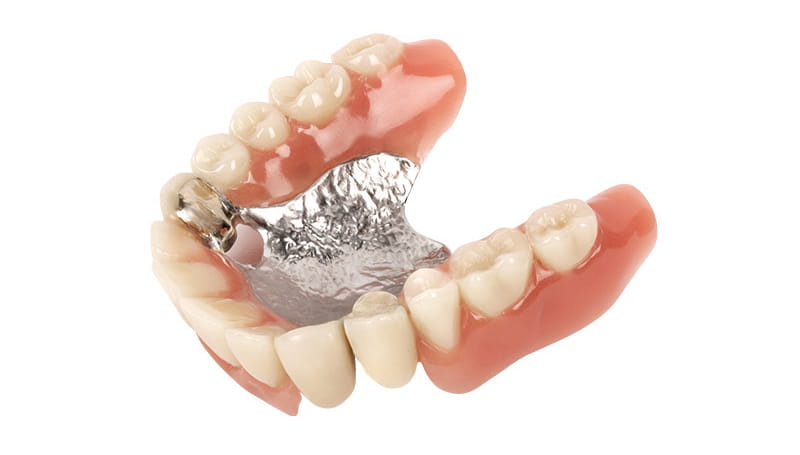 Rausnehmen zahnprothese Herausnehmbarer Zahnersatz: